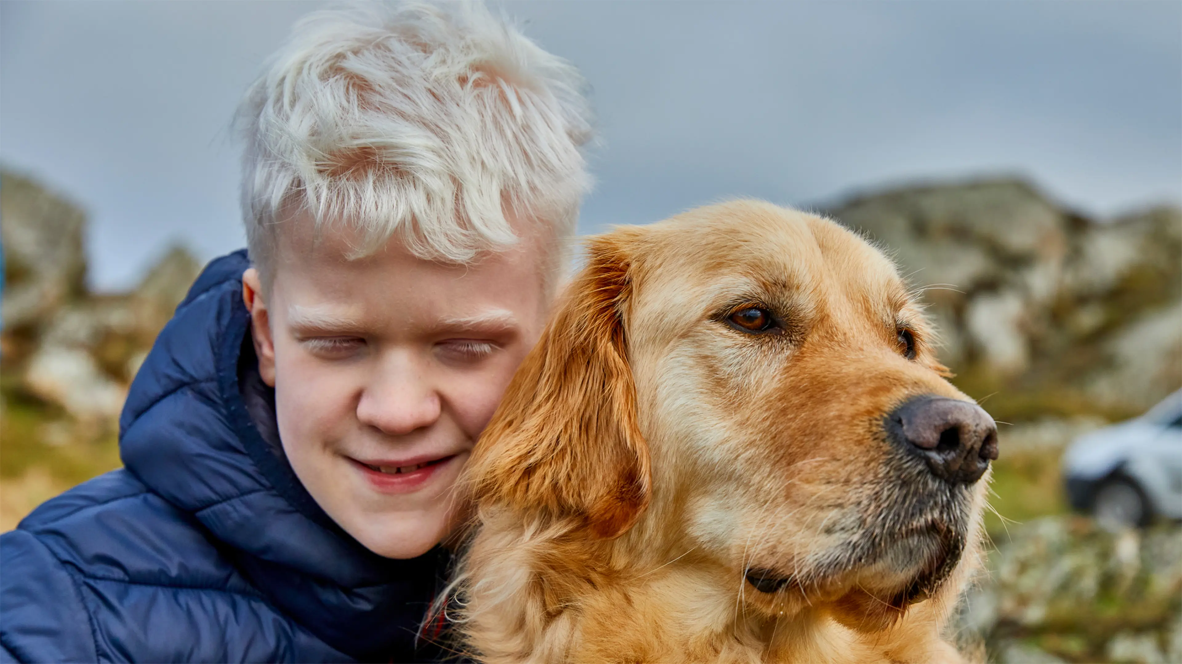 Ellis, who has albinism, sits close to his buddy dog, golden retriever Ralph.